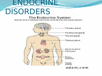 endocrine dis.pptx